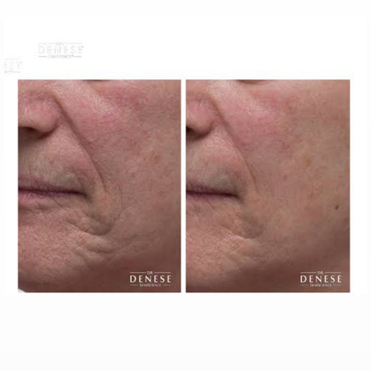 DR Denese -  Máscara de Firmeza de Colágeno 120 ml